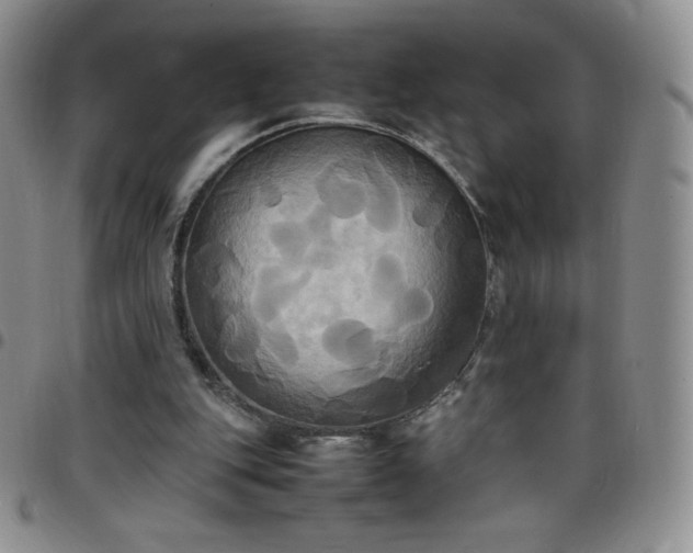 X0000099230151200805011144