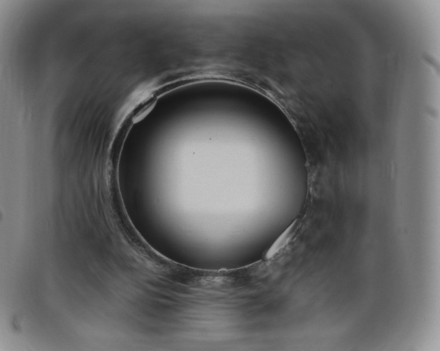 X0000099230152200805011144