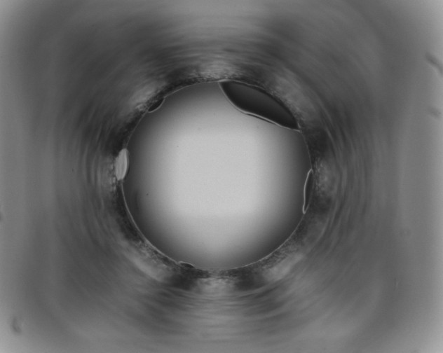 X0000099230356200805011141