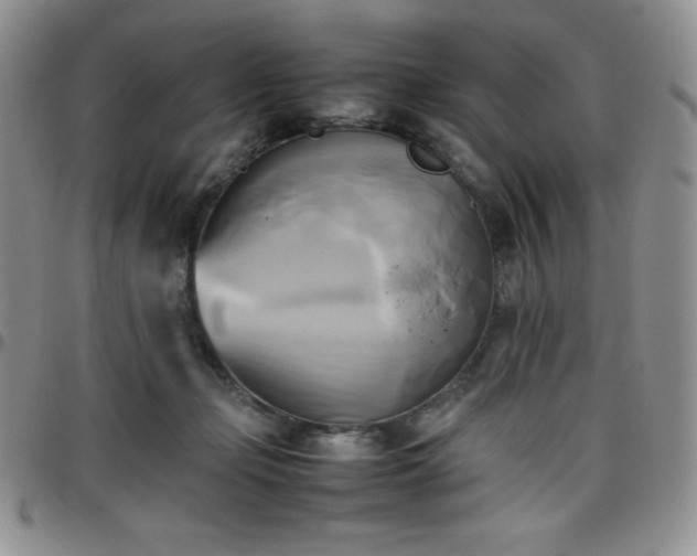 X0000099230365200805011141