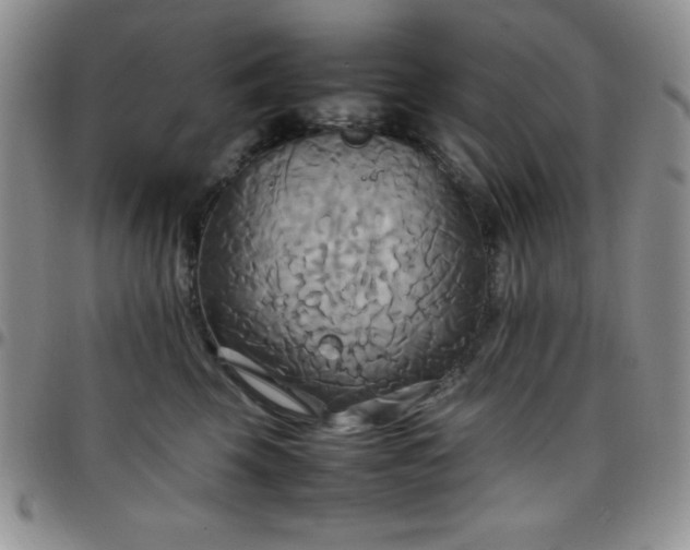 X0000099230569200805011139