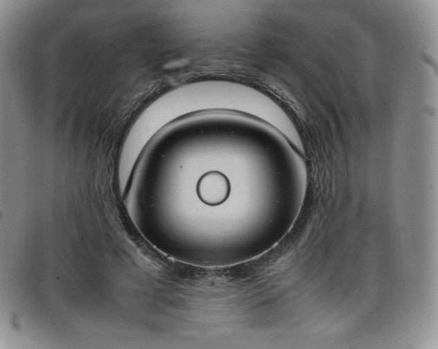 X0000099230593200805011138