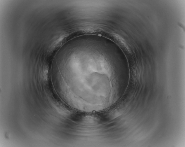 X0000099230596200805011138