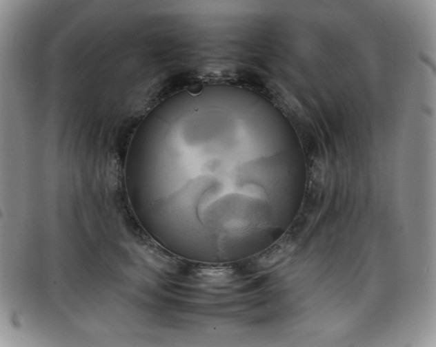 X0000099230659200805011138