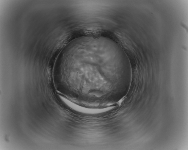 X0000099230699200805011137