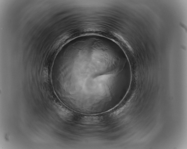 X0000099230825200805011135