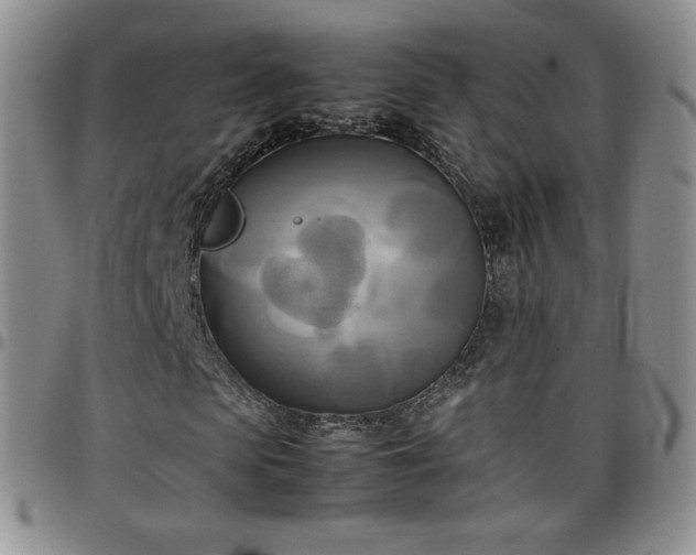 X0000099230913200805011133