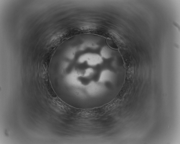 X0000099230917200805011133