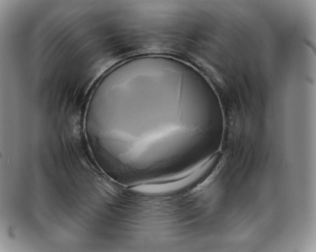 X0000099231170200805011130