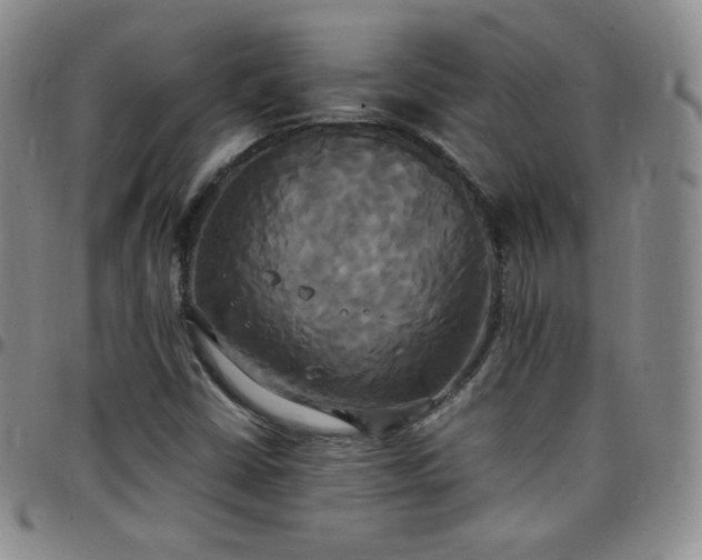 X0000099231402200805011127