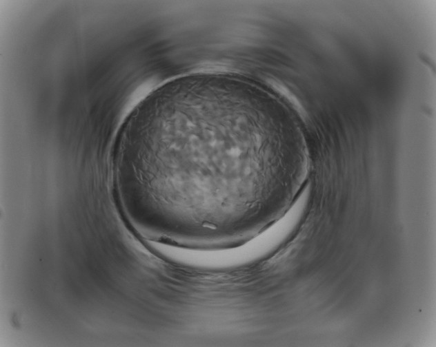 X0000099231467200805011126