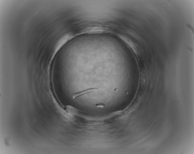 X0000099231475200805011126