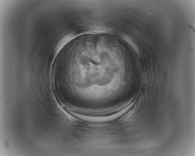 X0000099231487200805011126