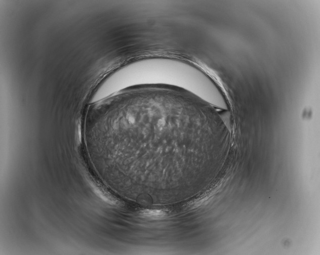 X0000099230061200805081607