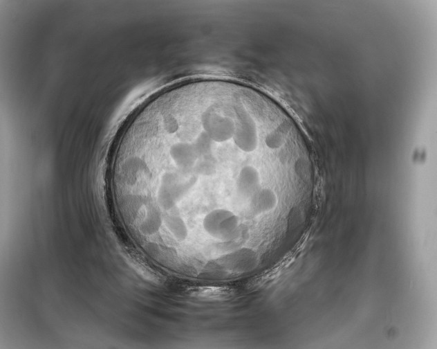 X0000099230151200805081605