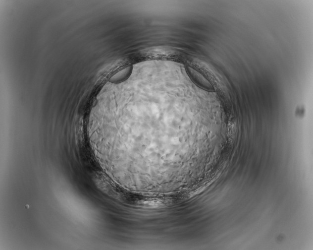 X0000099230381200805081603