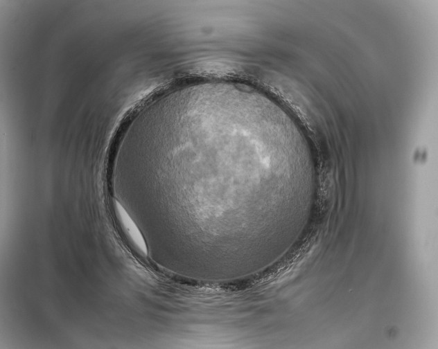 X0000099230399200805081602