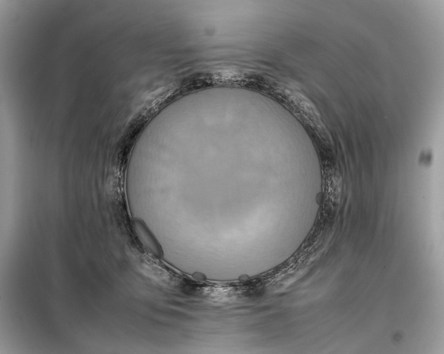 X0000099230419200805081602