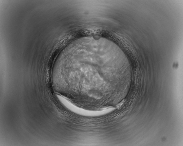 X0000099230699200805081557