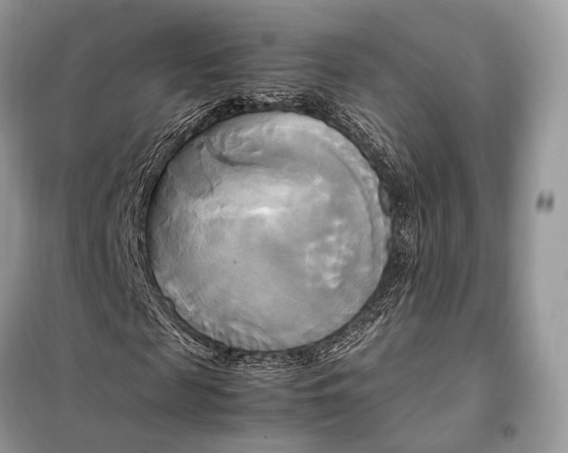 X0000099230817200805081555