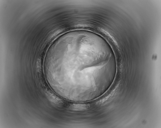 X0000099230825200805081555