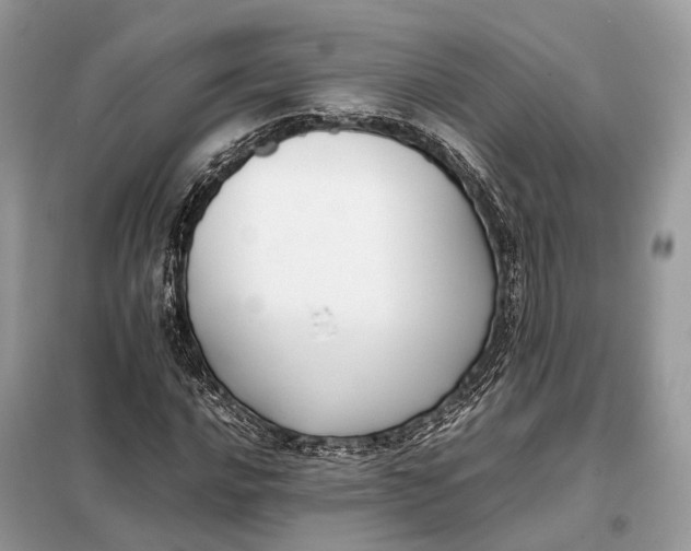 X0000099231016200805081552