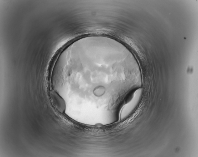 X0000099231071200805081552