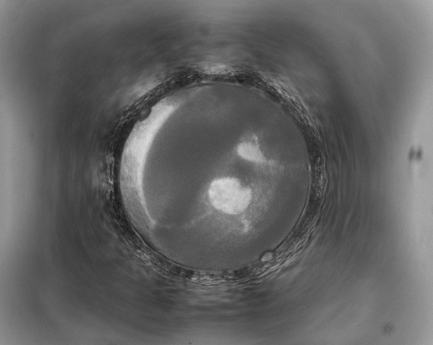 X0000099231301200805081548