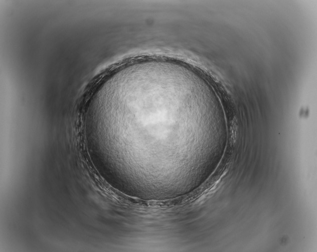 X0000099231494200805081545