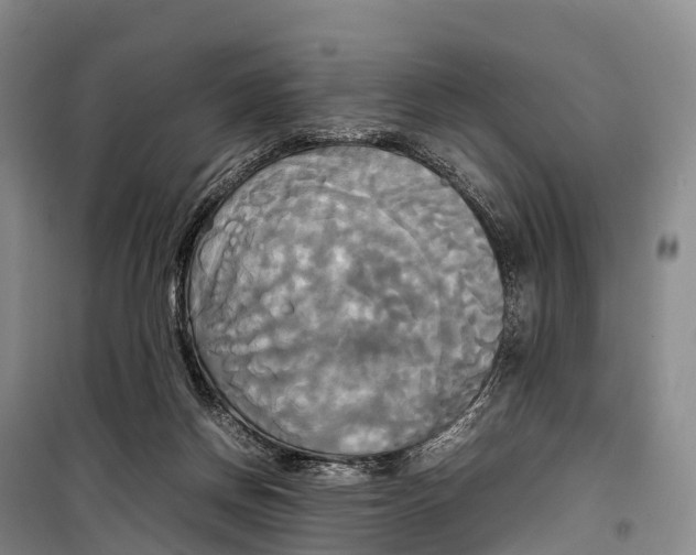 X0000099230166200805151638