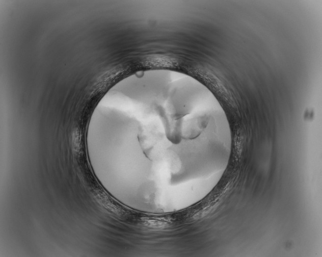 X0000099230359200805151635