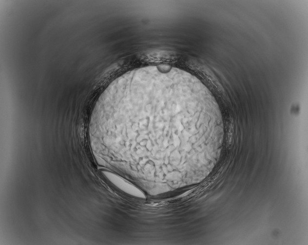 X0000099230569200805151632