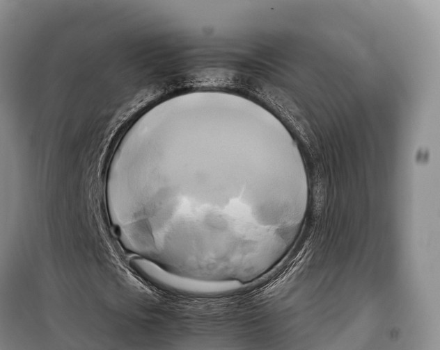 X0000099230721200805151629