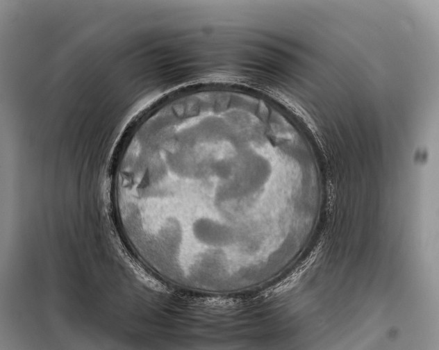 X0000099231029200805151625