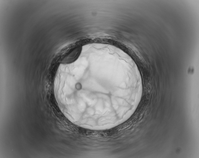 X0000099231063200805151624