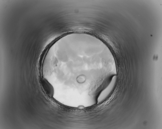 X0000099231071200805151624