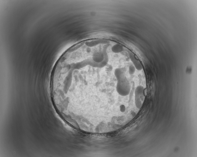 X0000099231103200805151624