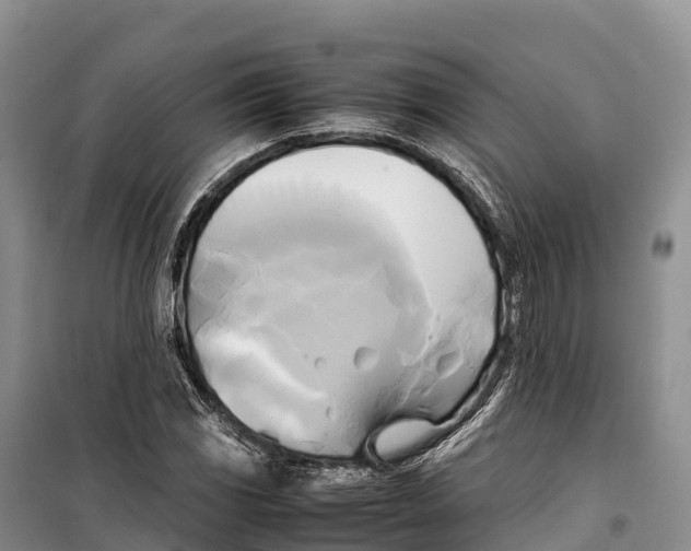 X0000099231117200805151623