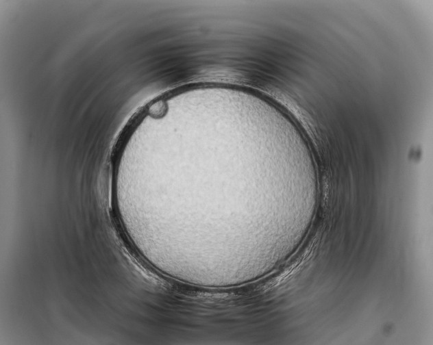 X0000099231123200805151623