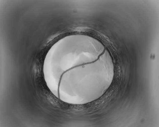 X0000099231158200805151623