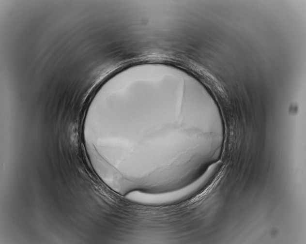 X0000099231170200805151623