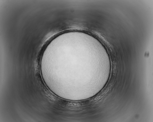 X0000099231215200805151622