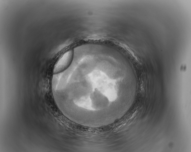 X0000099231350200805151620