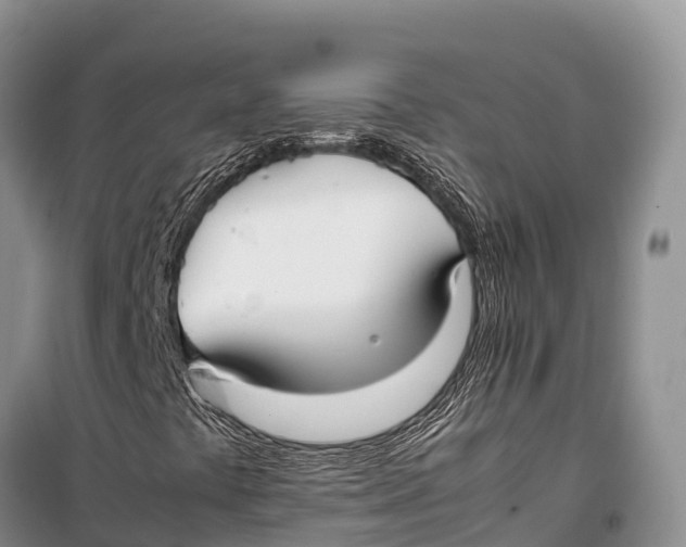 X0000099231441200805151619