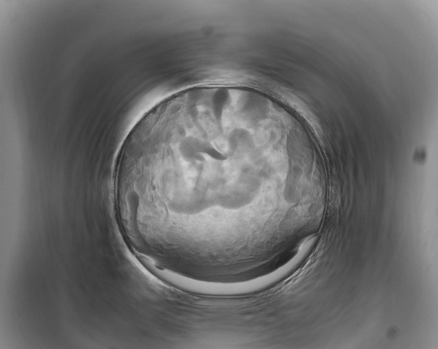 X0000099231487200805151618