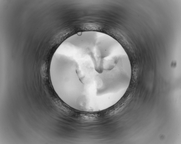 X0000099230359200805221841