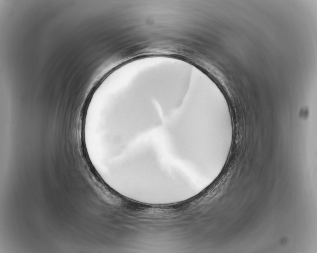 X0000099231179200805221829