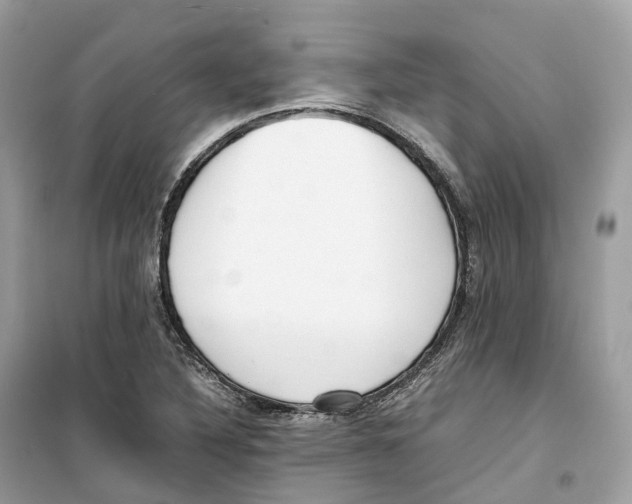 X0000099231316200805221827