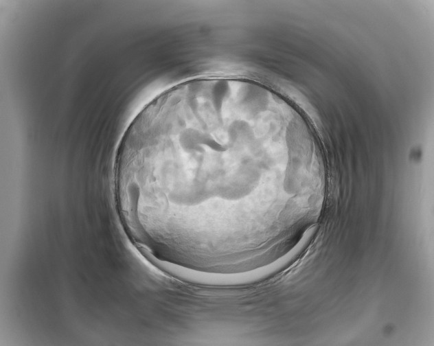 X0000099231487200805221825