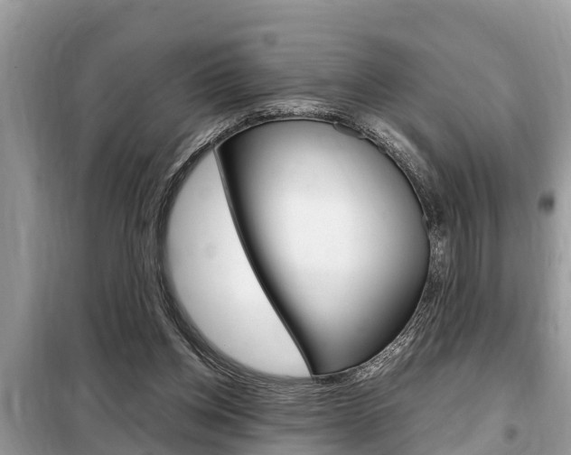 X0000099290158200805020741